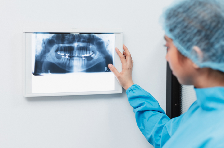 Dental X Rays