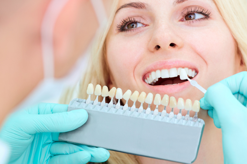 Teeth Whitening