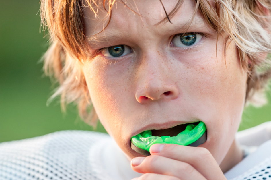 Mouthguards Gum Shields